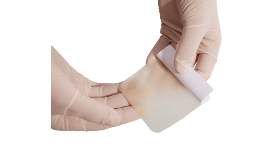 Hydrocolloid Wound Dressing