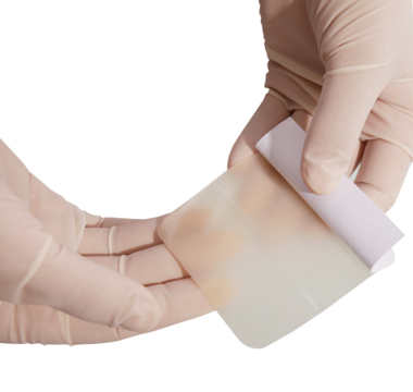 Hydrocolloid Wound Dressing